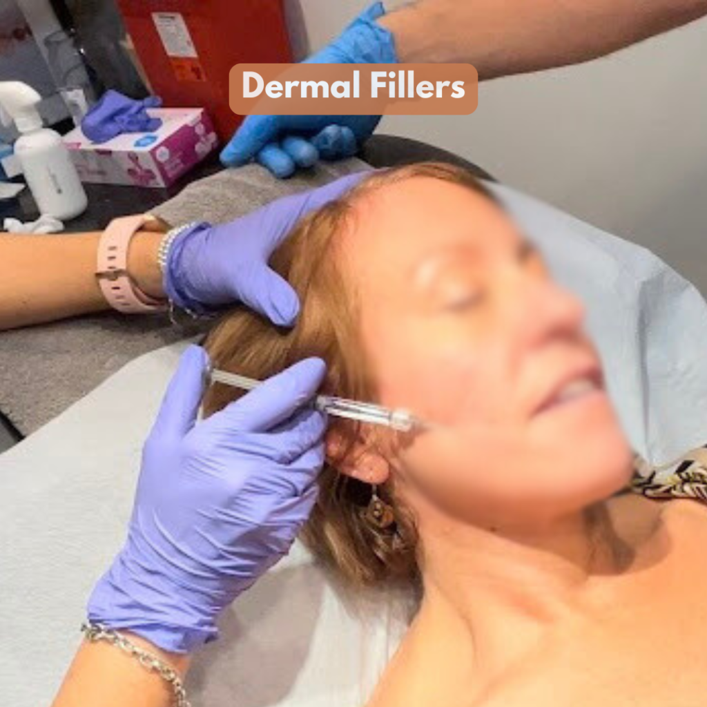 Dermal Fillers
