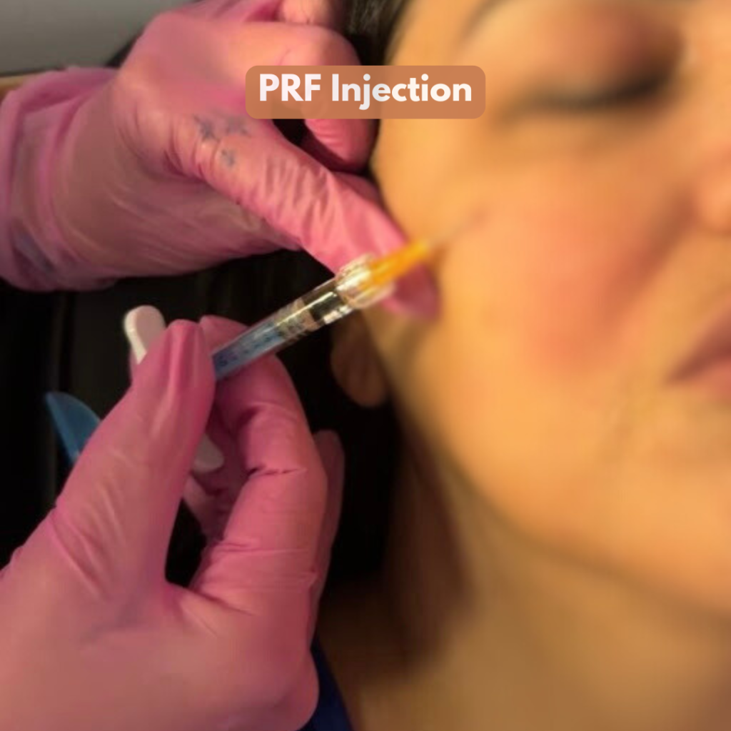 PRF Injection